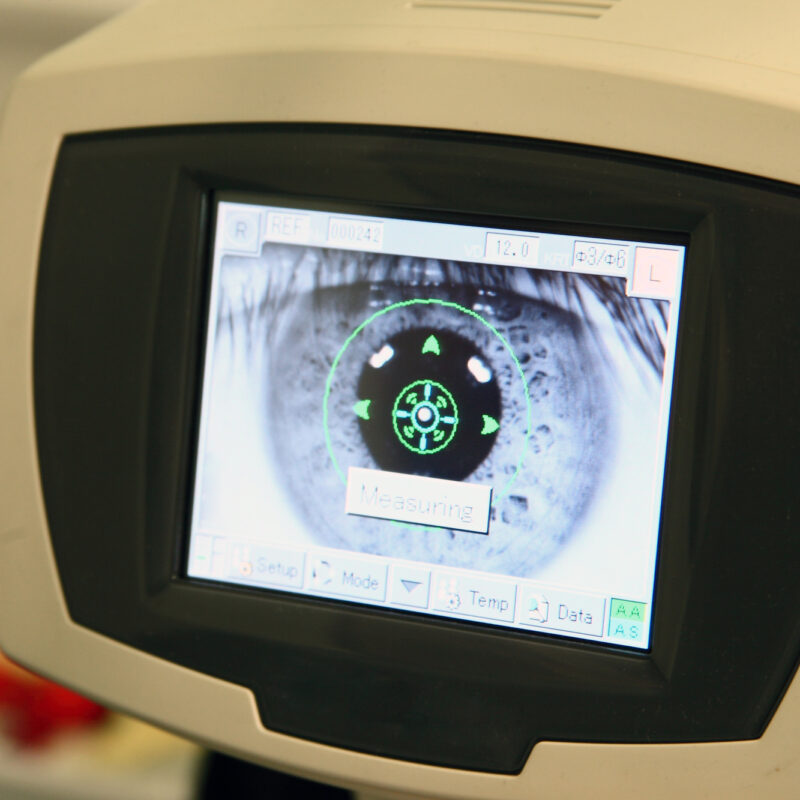 james-bontoft-optometrist-retina-scanner